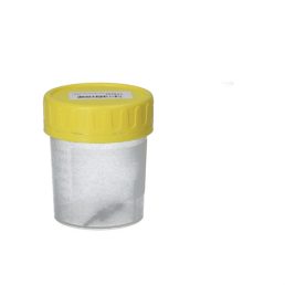 Urinprøvebæger 100 ml